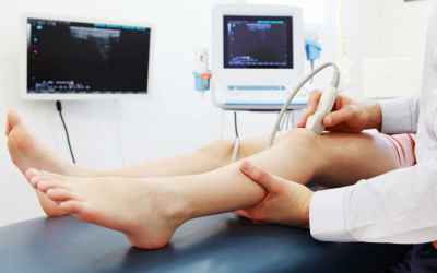 Doppler Ultrasound Exam of Arm or Leg